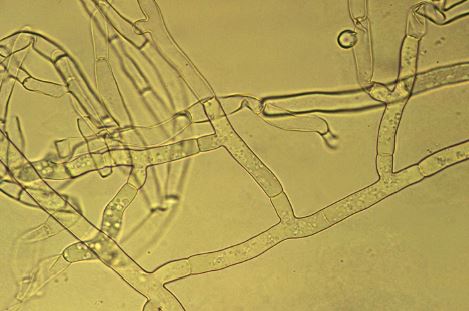 Pod mikroskopom - Hýfy sa vetvia v pravých uhloch