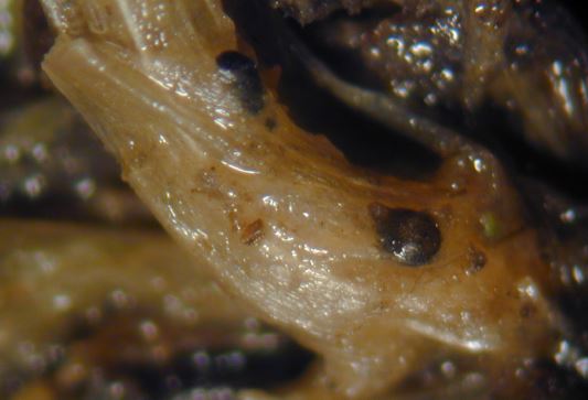 Bronzová škvrnitosť pod mikroskopom